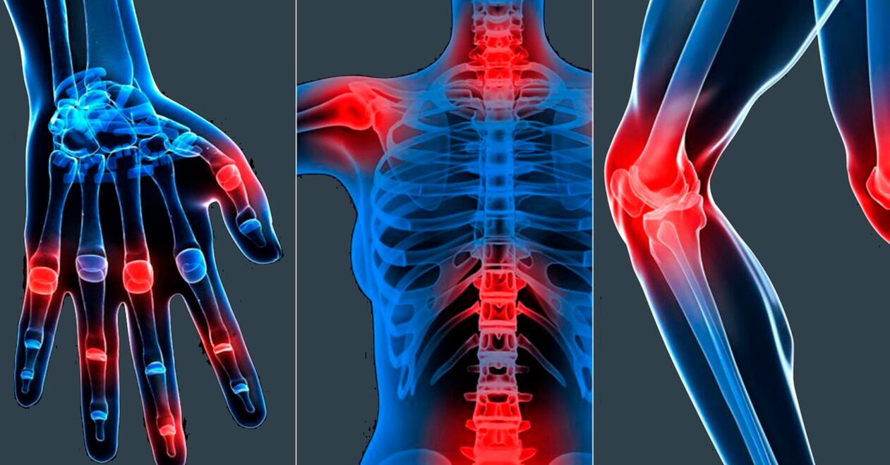 Indications d'utilisation de l'extrait de Boswellia en gélules.