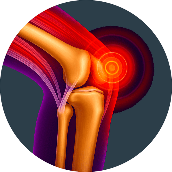 Inflammation articulaire